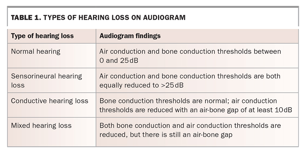 Sudden sensorineural hearing loss an urgent otological presentation